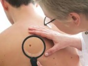 O que é Câncer de Pele? Quais os sintomas e como se Proteger