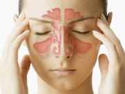 Sinusite: Sintomas, Causas e Tratamento